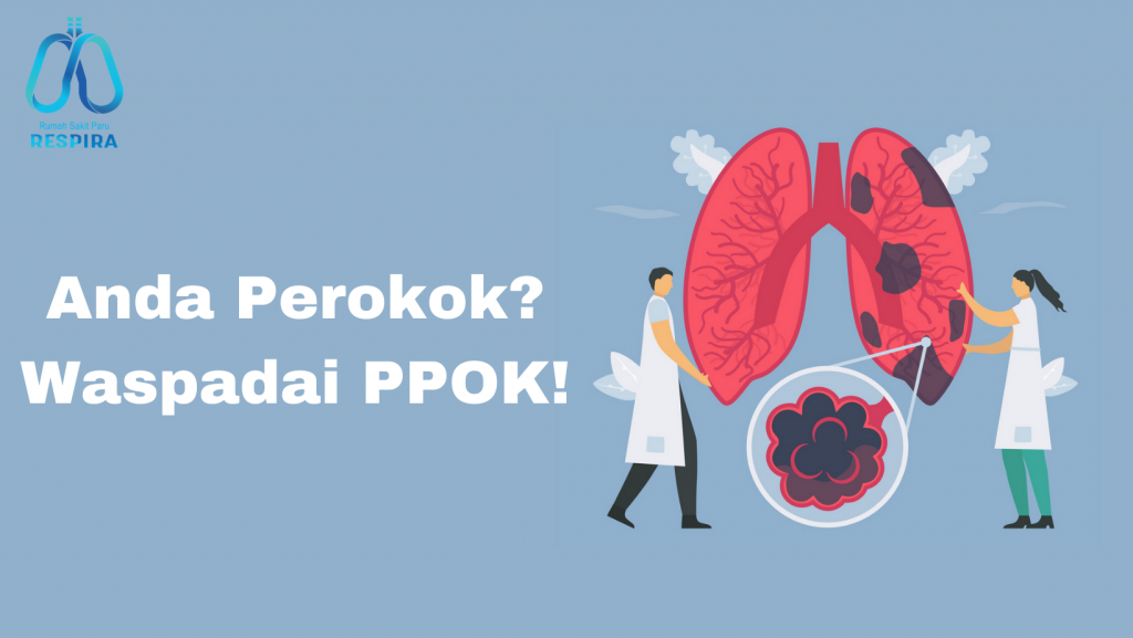 Anda Perokok Waspadai Ppok – Rsp Respira